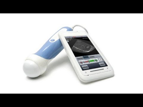 Ultrasound machine that fits in your pocket: The smartphone-based MobiUS