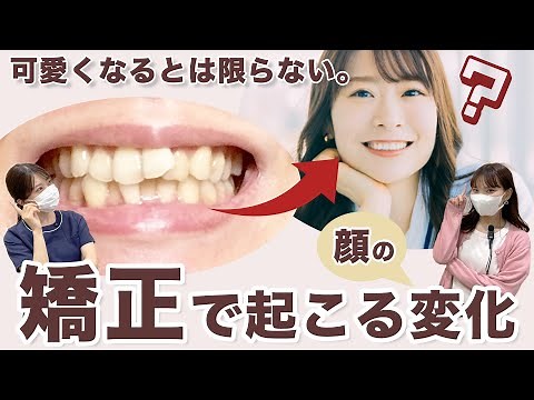 【矯正でブスになる？！】歯列矯正で頬ゴケ・人中伸び・ほうれい線が起こる？アンケートをもとに体験談を交えて解説【前編】