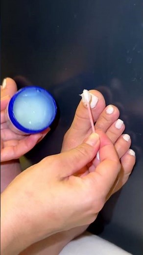 Here's how you can easily and quickly remove nail fungus