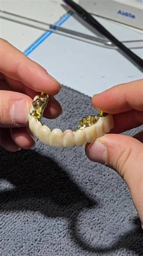 Barre Direct Implant Techniques for Dentists