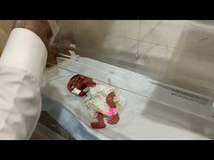 Giving Medication to a 26 Weeks Premature Baby | NICU Care Routine #PreemieBaby #nicucare