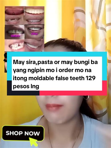 Moldable False Teeth Tutorial: Affordable DIY Solution