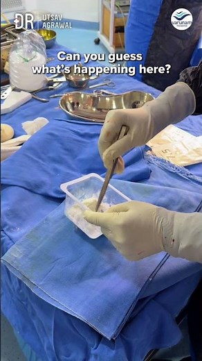 Bone Cement Preparation During Joint Replacement Surgery | Dr. Utsav Agrawal
