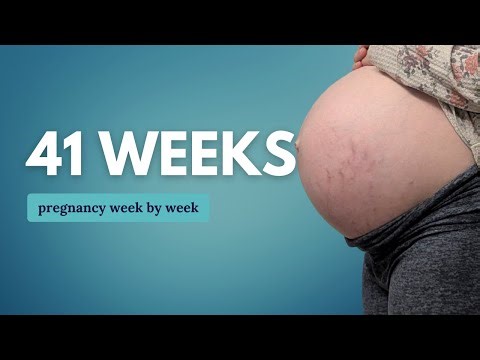 41 Weeks Pregnant 🤰 What to Expect When You Are Past Due