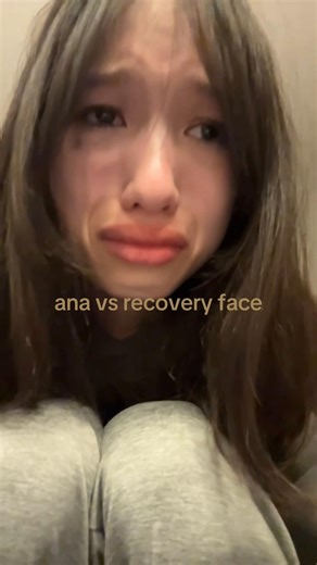 mads.wieiads. (@maddisch39d)’s video of recovery face