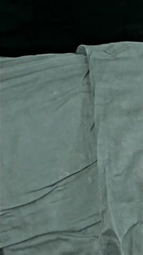 intact sac of Sebaceous cyst