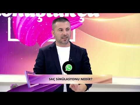 Saç Simülasyonu nedir ?