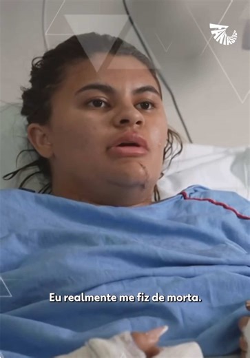 O caso de Ana Clara , jovem de Quixeramobim vítima de uma brutal tentativa de feminicídio, será destaque no Fantástico, da TV Globo. Você vai acompanhar a entrevista exclusiva com a jovem que teve as mãos decepadas no interior do Ceará, em um relato forte que chocou o país; Reprodução: (Fantástico, TV Globo). Siga ↪️ @juventudequixeramobim para mais vídeos. - - - - - - - - - - - #quixeramobim #ceara #fyy #nordeste #noticia @Juventude Quixeramobim @Juventude Quixeramobim @Juventude Quixeramobim