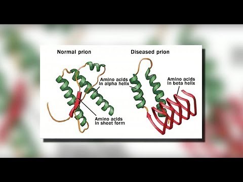 CJD Creutzfeldt-Jakob Disease - Mayo Clinic