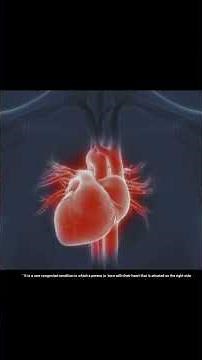 What is Dextrocardia?#shorts