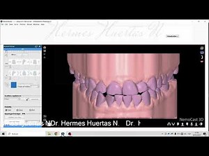 Set Up Ortodóntico Quirúrgico Nemocast