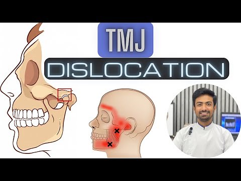 TMJ Dislocation and Management