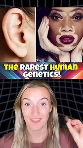 128K views · 1.3K reactions | The RAREST Human GENETICS! | The Blondie Girl | Facebook