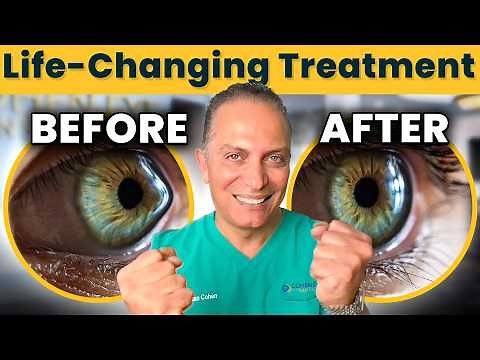 Keratoconus surgery: Crosslinking + Topography-Guided PRK Eye Surgery