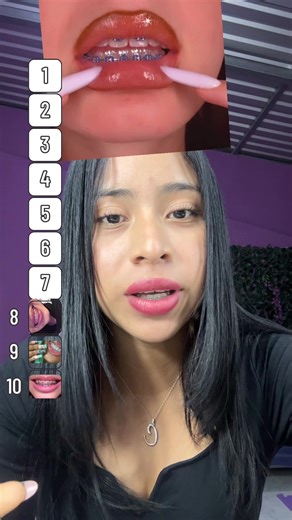 Filtro de Brackets: ¿Qué Color Me Toca Esta Vez?