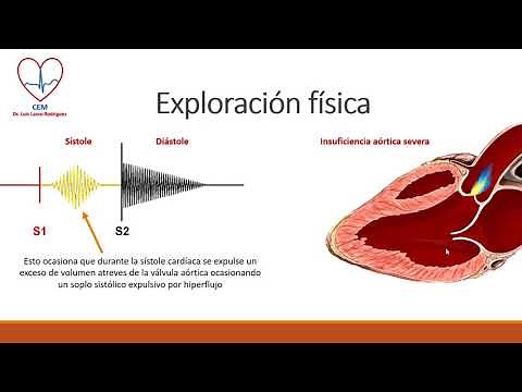 Aortic insufficiency