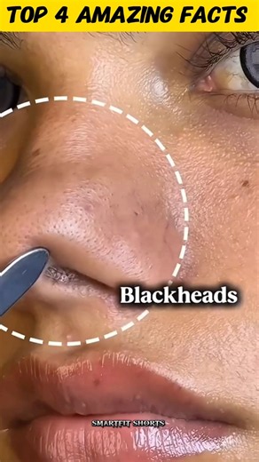 3 Common Beauty Problems Ke Simple Gharelu Tips!😱💯 #facts #haircare #dandruffcontrol #blackheads