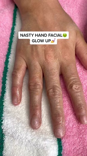Dry Hands Glow Up: Rescue Your Crusty Hands!