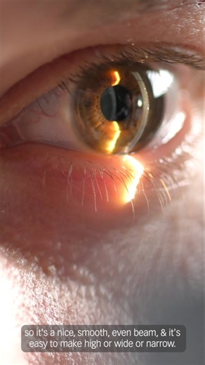 Haag Streit Group on Instagram: "With our new Elara 900 slit lamp, it really is possible to “see more.” Our revolutionary projector “P-Type” light source illumination can emit colors across the entire visible spectrum, delivering a high-resolution high-contrast examination to enable efficient identification of ocular structures and pathologies. Working hand-in-hand with our digital “presets,” you get the right light for every detail – while saving time on every exam. In this video, Yuri McKee, o