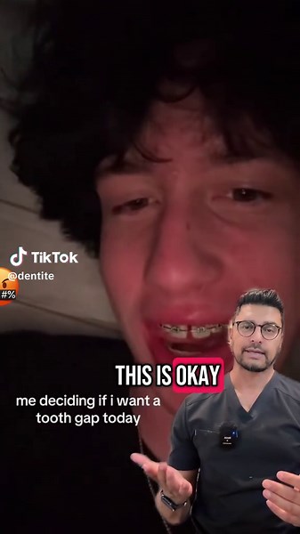 Delta Dental Coverage for Veneers: Key Insights