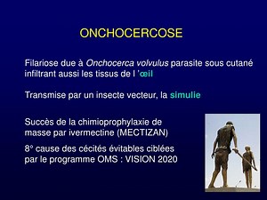 ONCHOCERCOSE - SlideServe