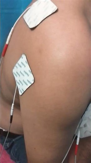 🎯 Shoulder Pain Relief with IFT (Interferential Therapy) Relaxation Treatment🔥💯✅ #painrehabb