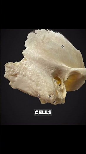 The Temporal Bone Anatomy! Structure and Main Components! 🧠