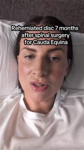 Its got to be slowest boring frustrating process everrr😅 #backpain #herniateddisc #spinal #sciaticapainrelief #spinalsurgeryrecovery