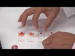 Bloeduitstrijkjes UVDL Faculteit Diergeneeskunde Utrecht