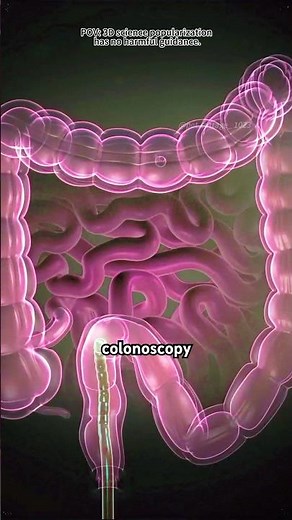 How Colonoscopy is performed?(3D Animation)