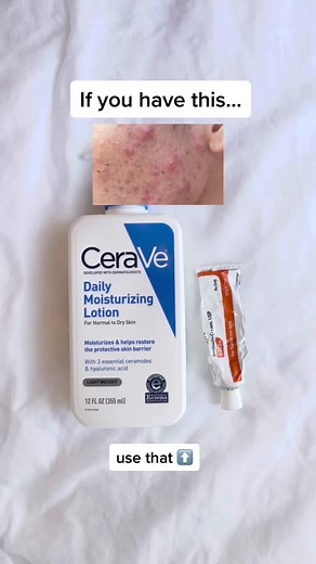 Skincare Tips: The Ordinary Skincare Quiz