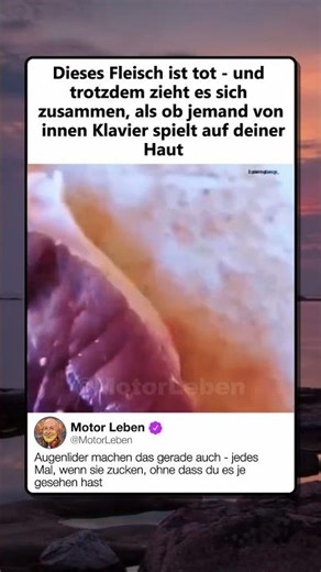 TOTES FLEISCH BEWEGT SICH NOCH