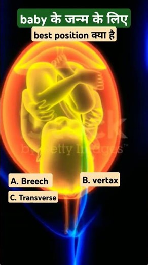 baby delivery best position | delivery MCQ | #shorts #biology #medical #nursing