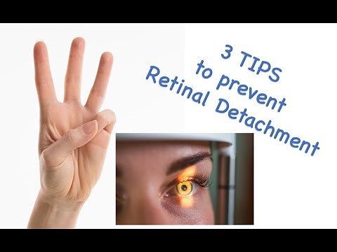 3 tips to prevent retinal detachment/ #retinaldetachment