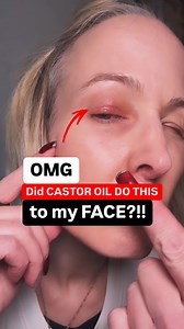 120K views · 1K reactions | Super Easy Oil Recipe to get rid of a...