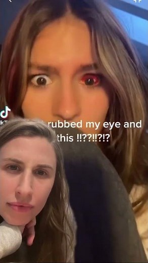Bleeding Into Your Eyeball?! What is going on here???