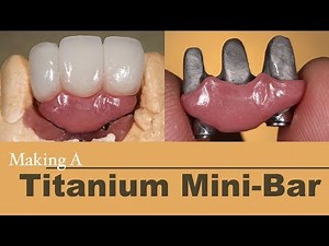 Making A Titanium Mini-Bar With Porcelain Bridge | Dental Lab Learning
