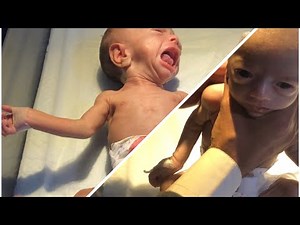 How to Give Bottle Feeding to Your Baby | Step-by-Step Guide" #feeding #feedshorts