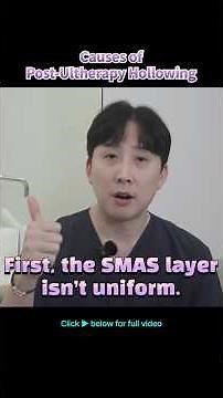 Ultherapy Hollowing Side Effects?😮 Why Your Face Can Show Volume Loss — Explained in Seconds!