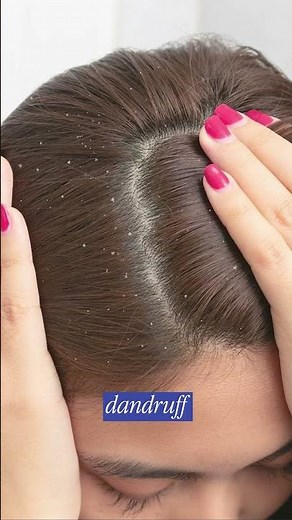 Is Hard Water Causing Your Hair Fall | Dermatologist Explains