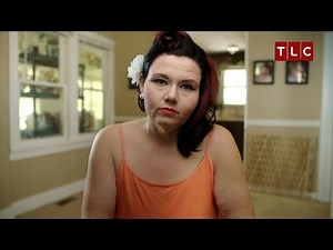 Excess Skin | Skin Tight