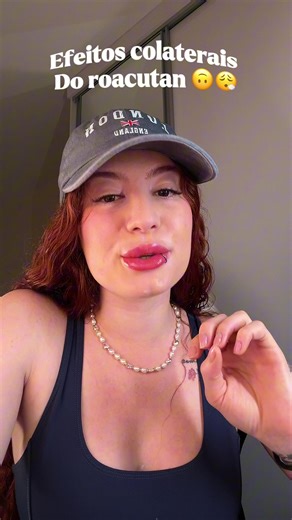 Meus efeitos colaterais usando o roacutan 🤯 #roacutan