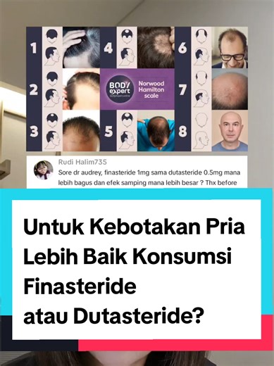 Perawatan Rambut Pria: Finasteride VS. Dutasteride