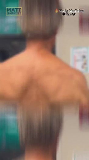 Understanding Scapular Winging: Causes and Exercises