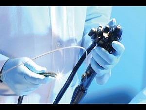 Πως γίνεται η γαστροστομία, γαστροσκόπιο