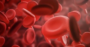 Cryoglobulinémie : définition, type, symptômes, traitement