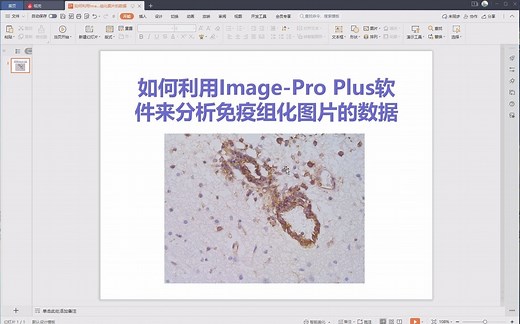 如何利用Image-Pro Plus软件来分析免疫组化图片的数据