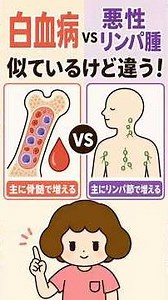 白血病と悪性リンパ腫の違い！