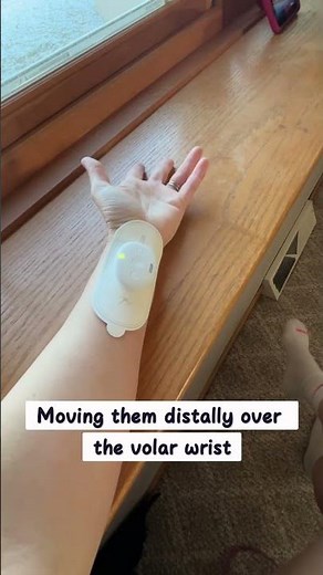 Electrode placement for finger flexion with FES using Syrebo wireless e-stim unit for stroke rehab