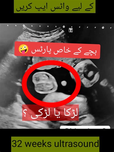 Baby Gender Ultrasound: Pregnancy Journey Revealed